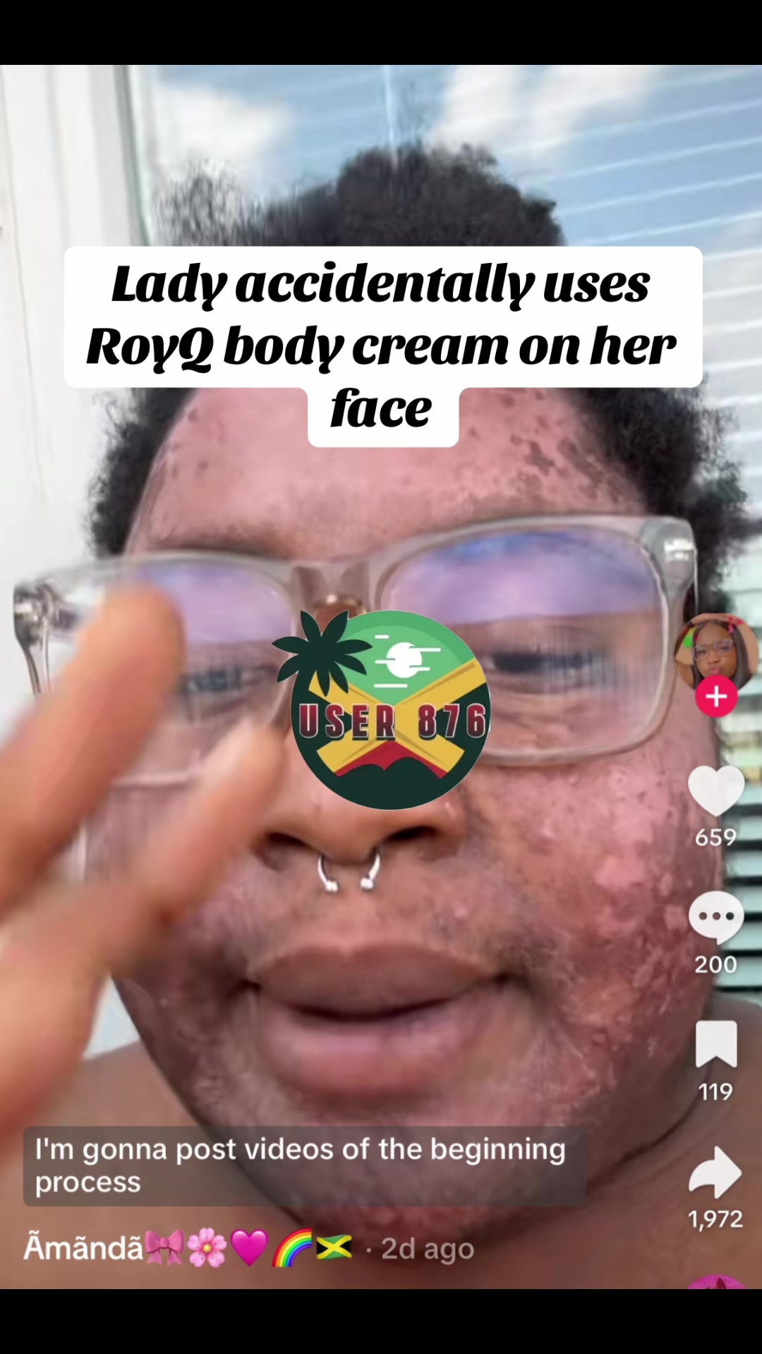 @User_876