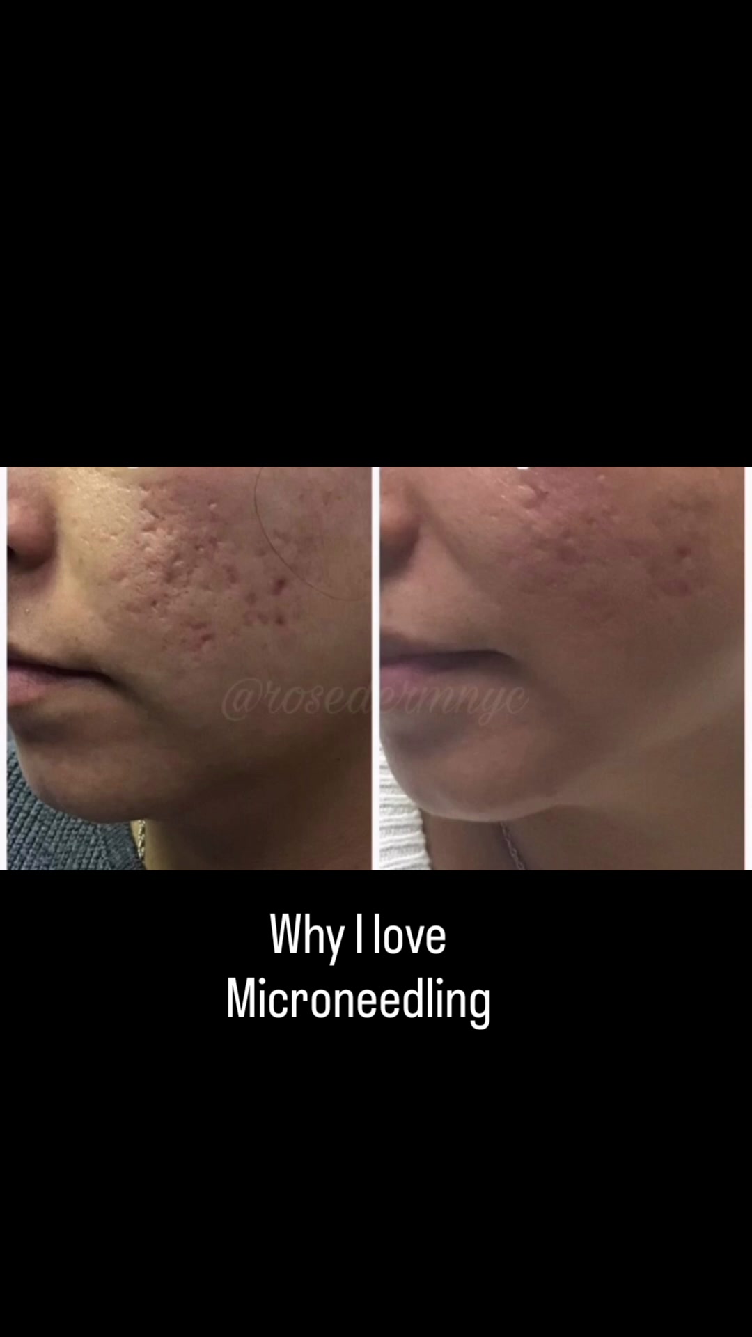 @Rosedermnyc