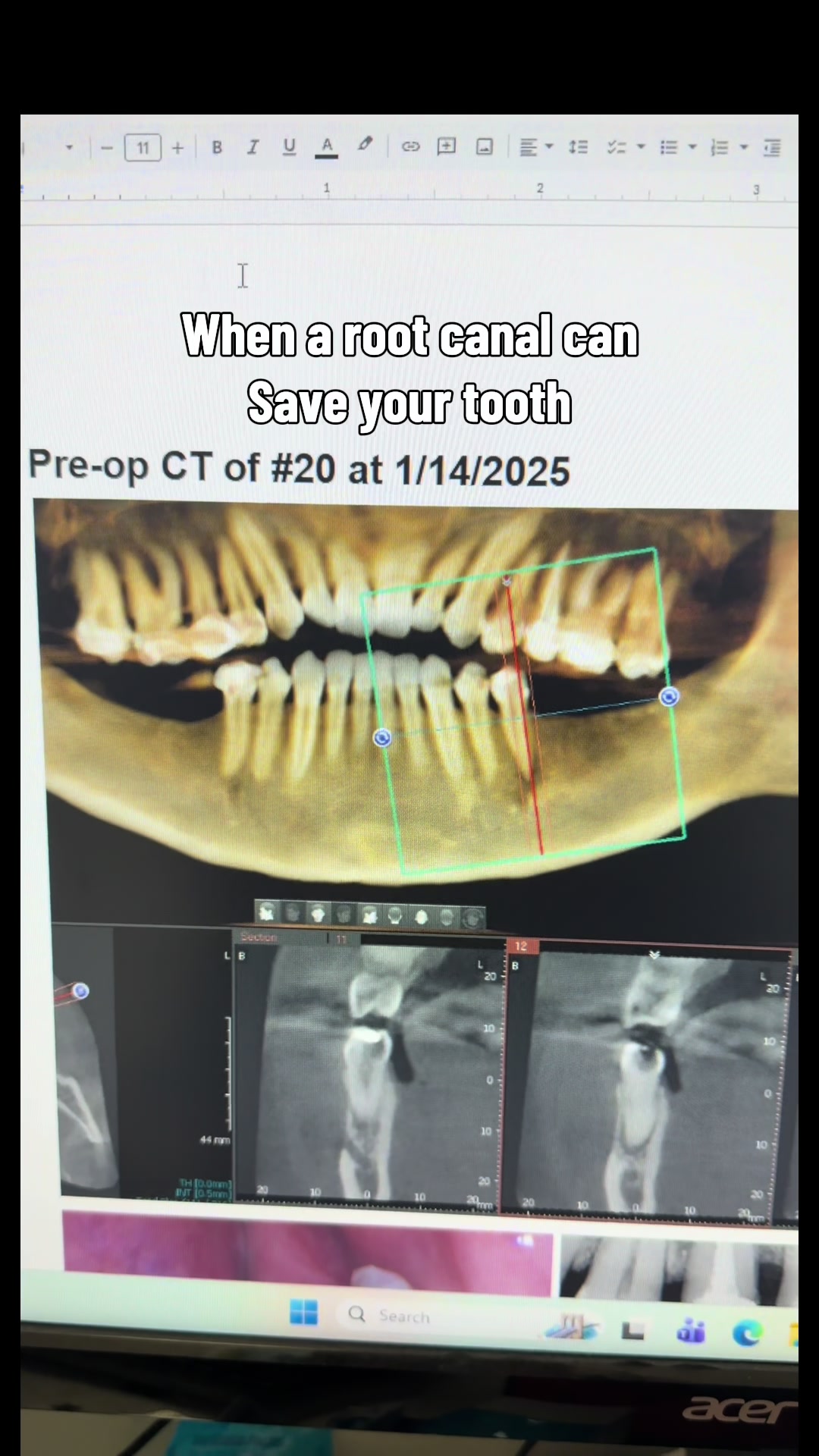 @Pristine Smiles Dental