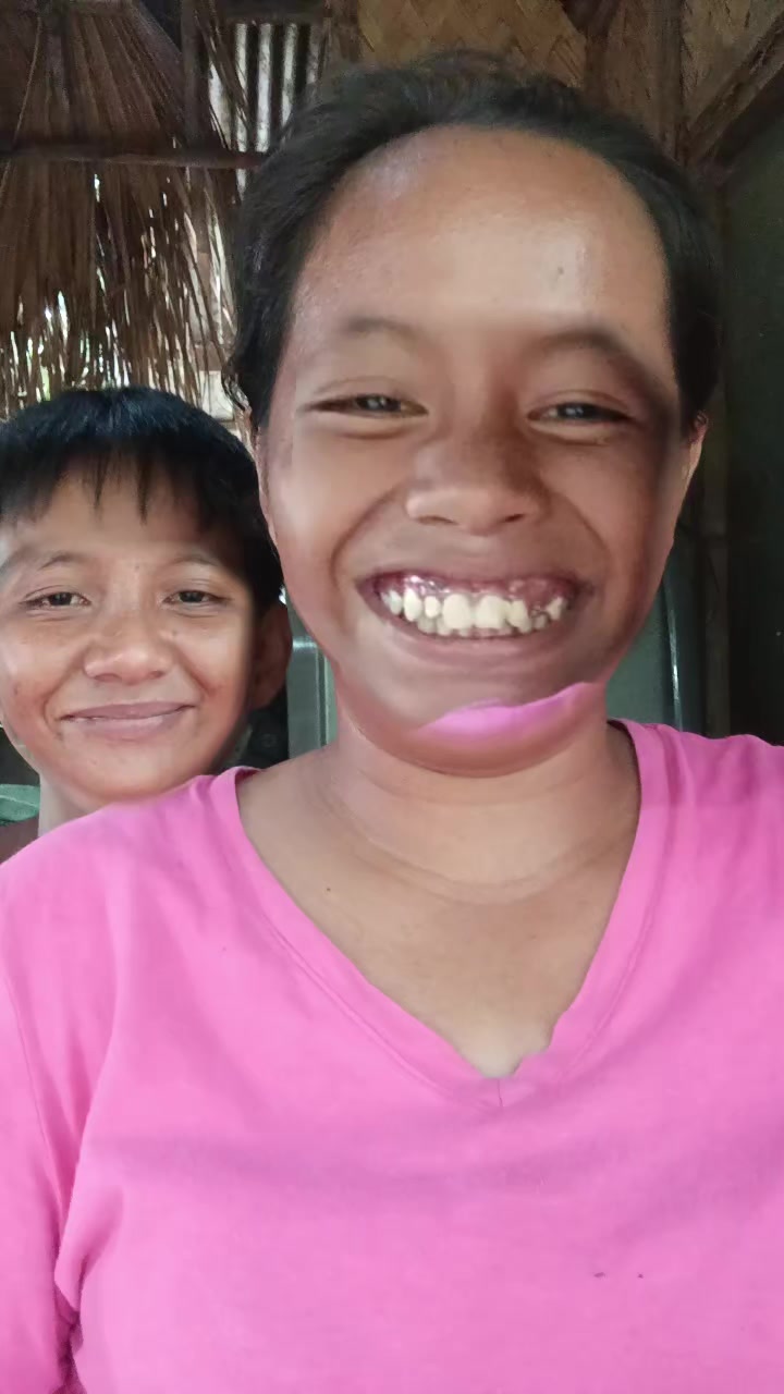 @bungal🤪✅