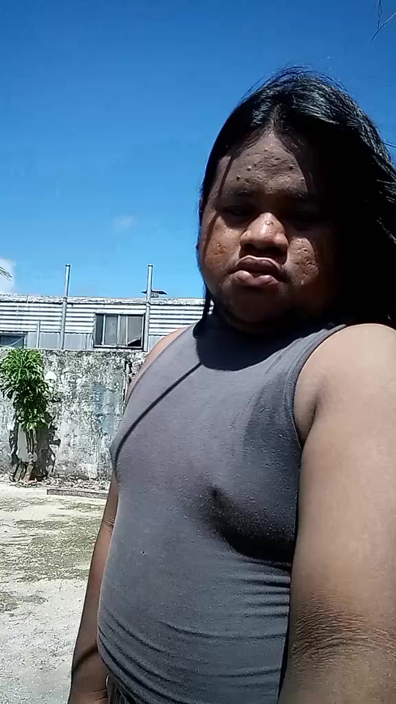@Chino Rujke