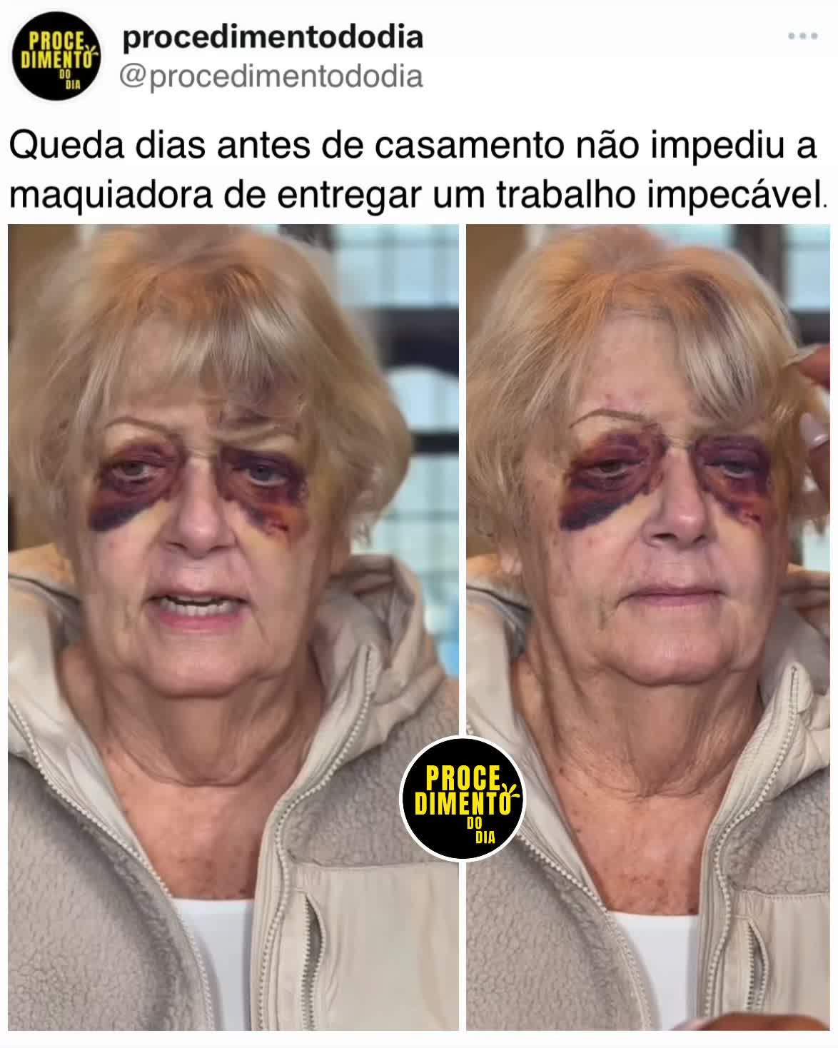 @procedimentododia