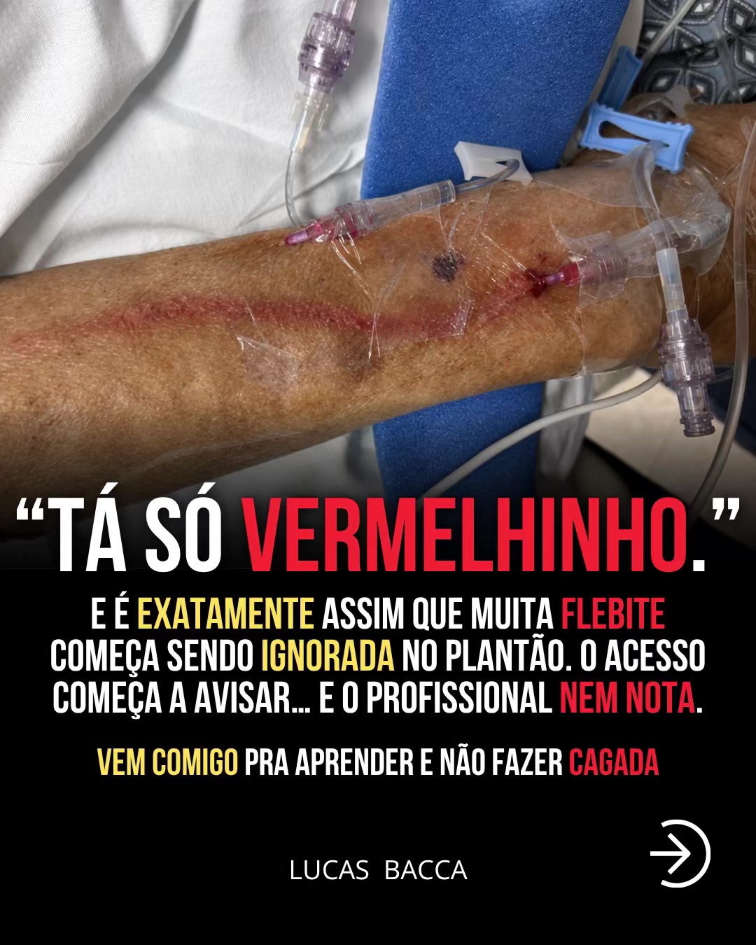 @Lucas Bacca | Enfermeiro