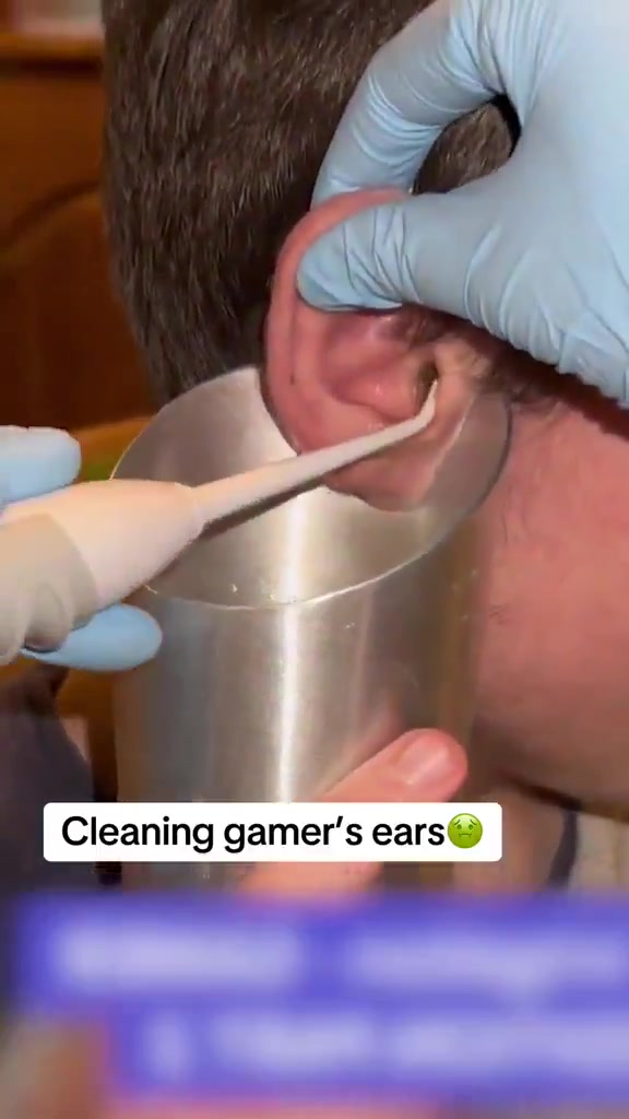 @Satisfying Ear Cleaning Videos