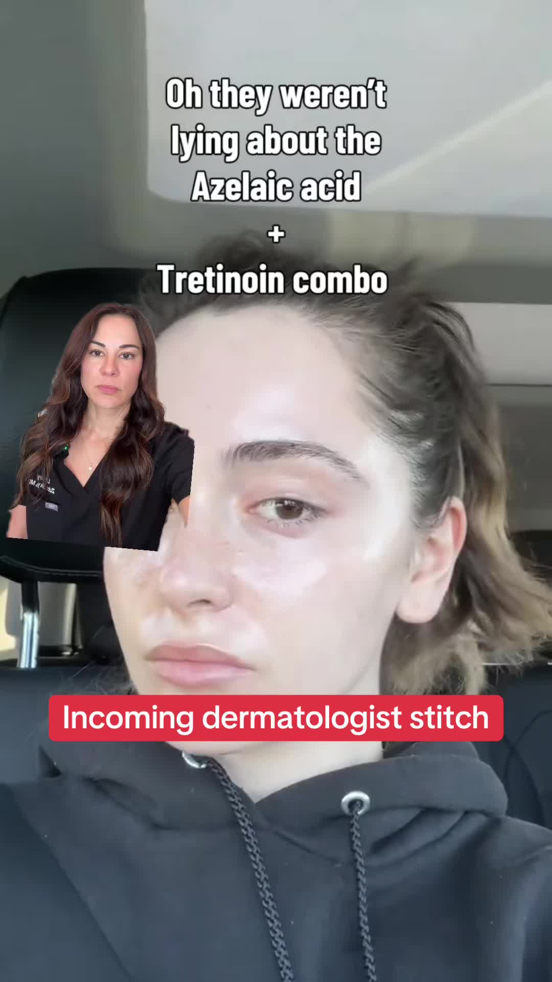 @Dermguru