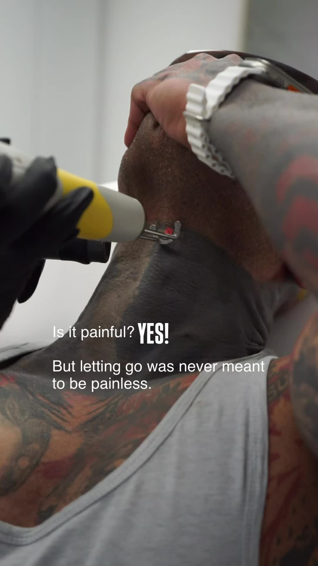 @@BHLASERTATTOOREMOVAL