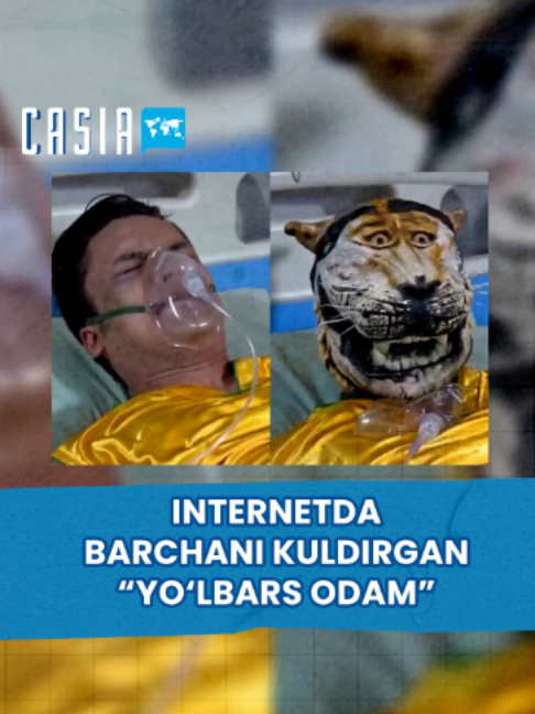 @Casia
