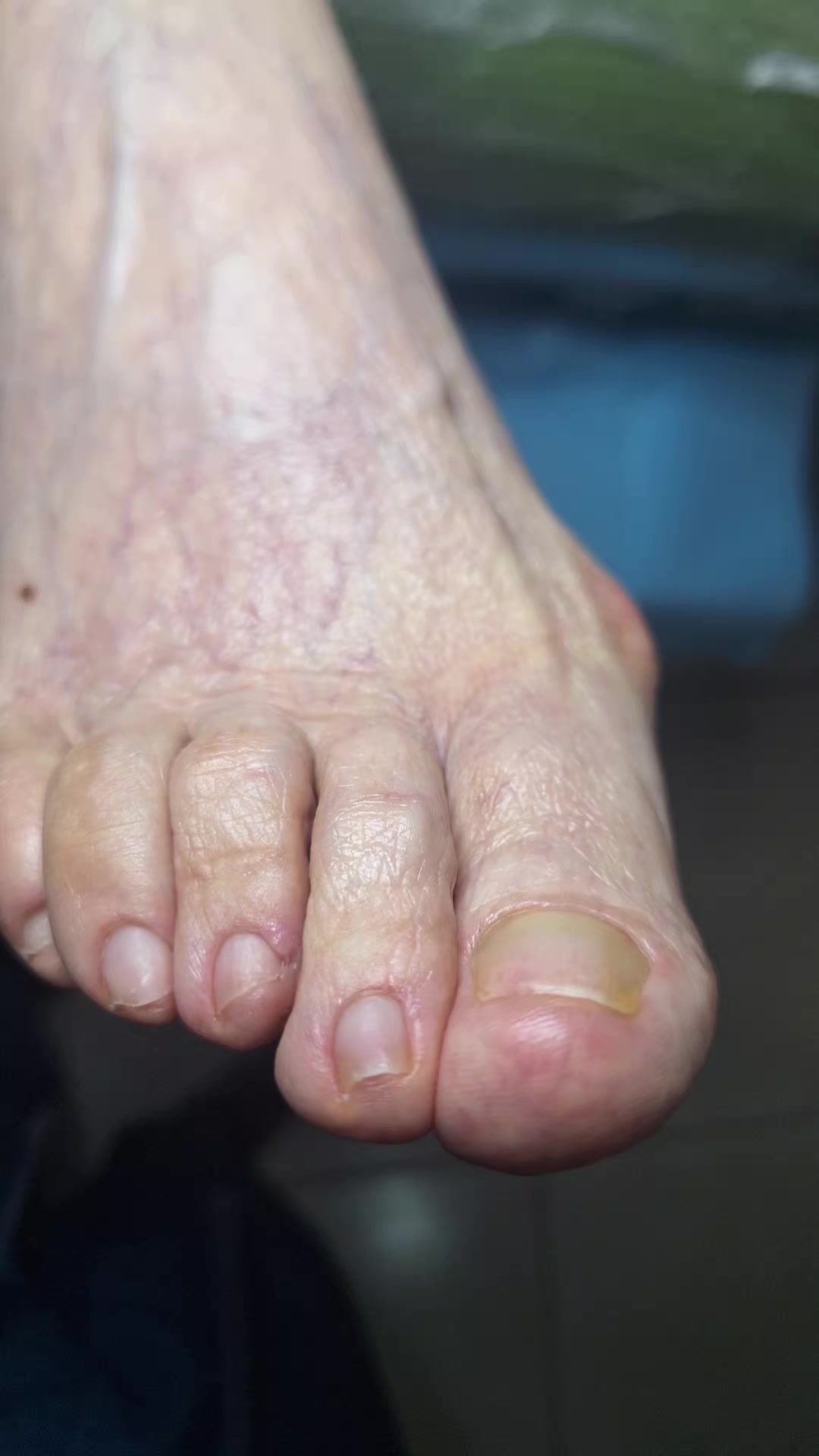 @Quiropodia HAPPY FOOT🇨🇷