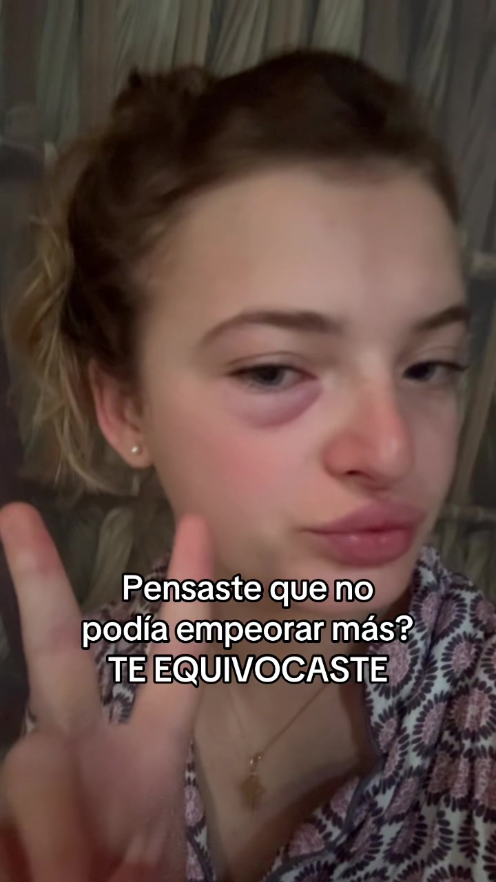 @Antonia Allende