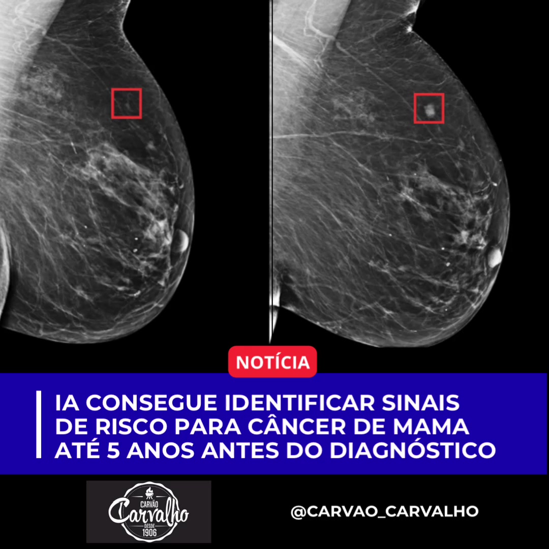 @Pablo Informa