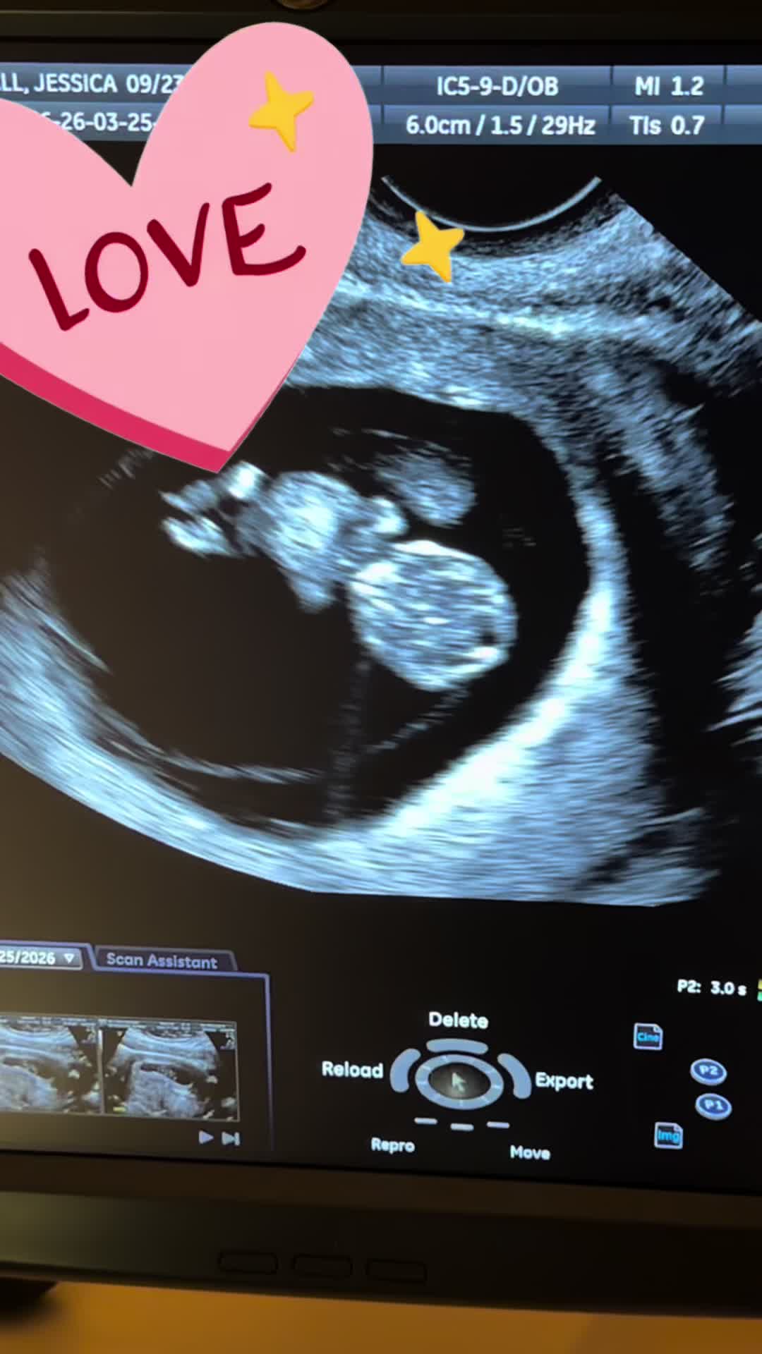 @Jessticles 💕🥰
