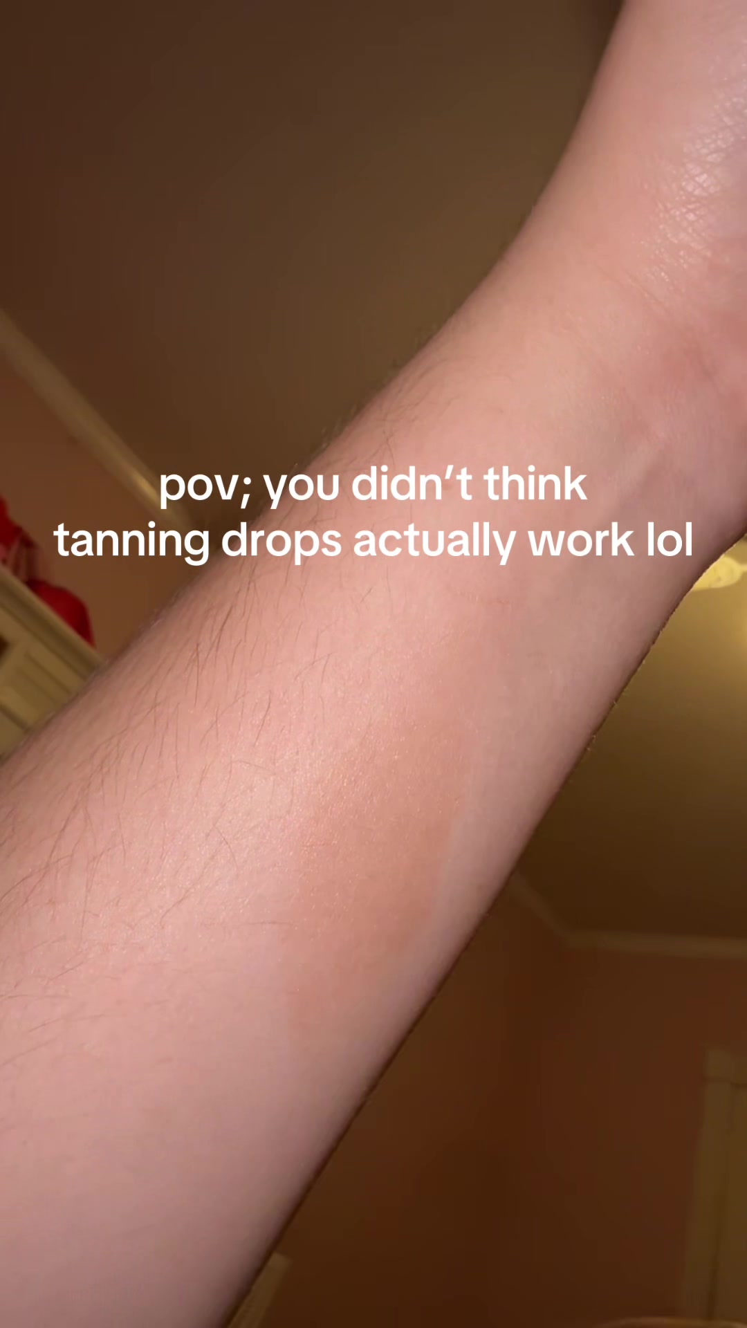 @unknown gg