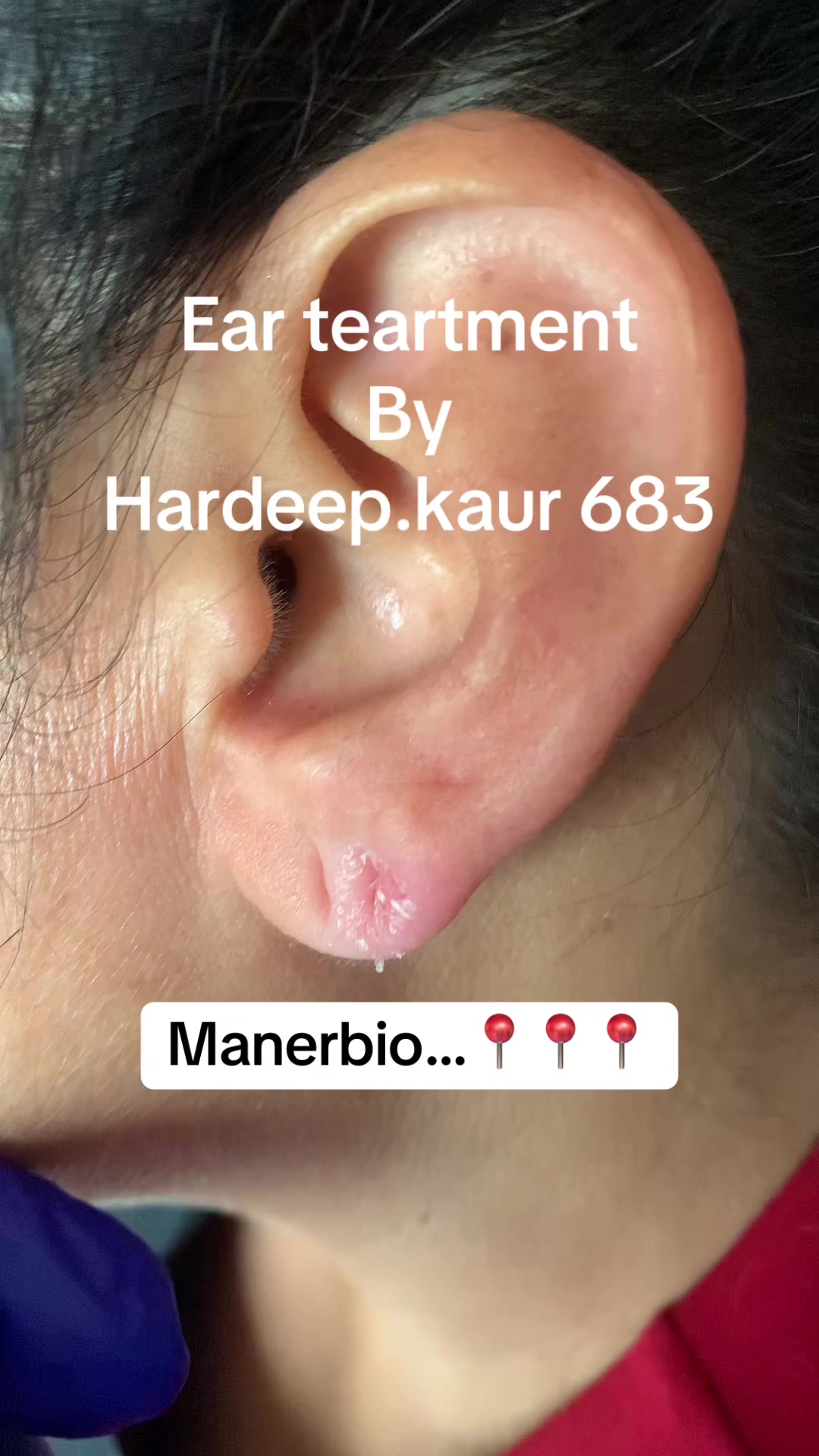 @Hardeep Kaur