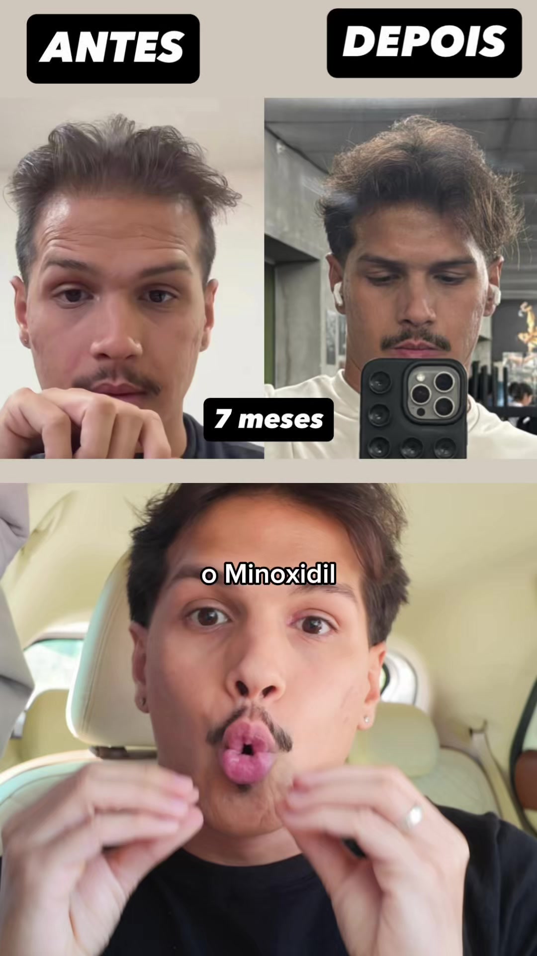 @Rogério Araújo