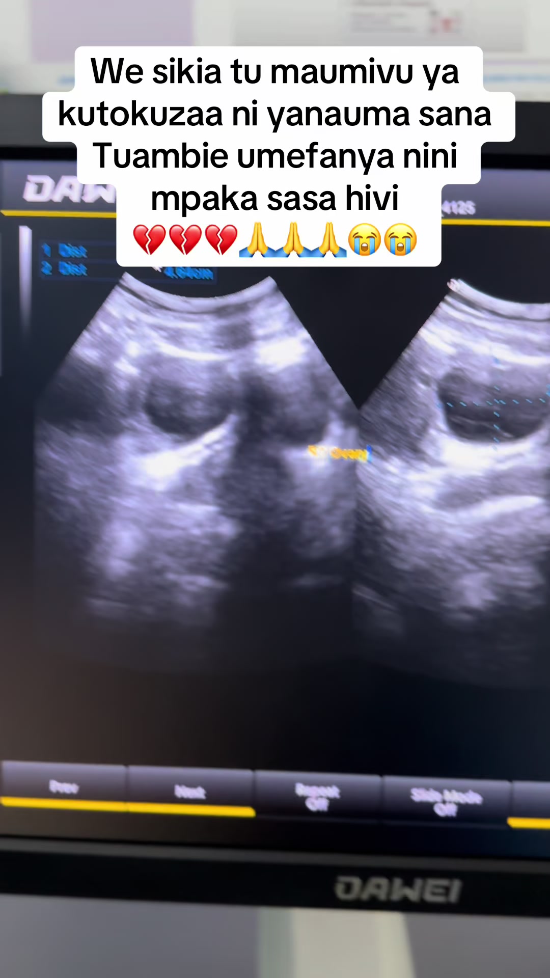 @Doctortiktoktz📞0693676137