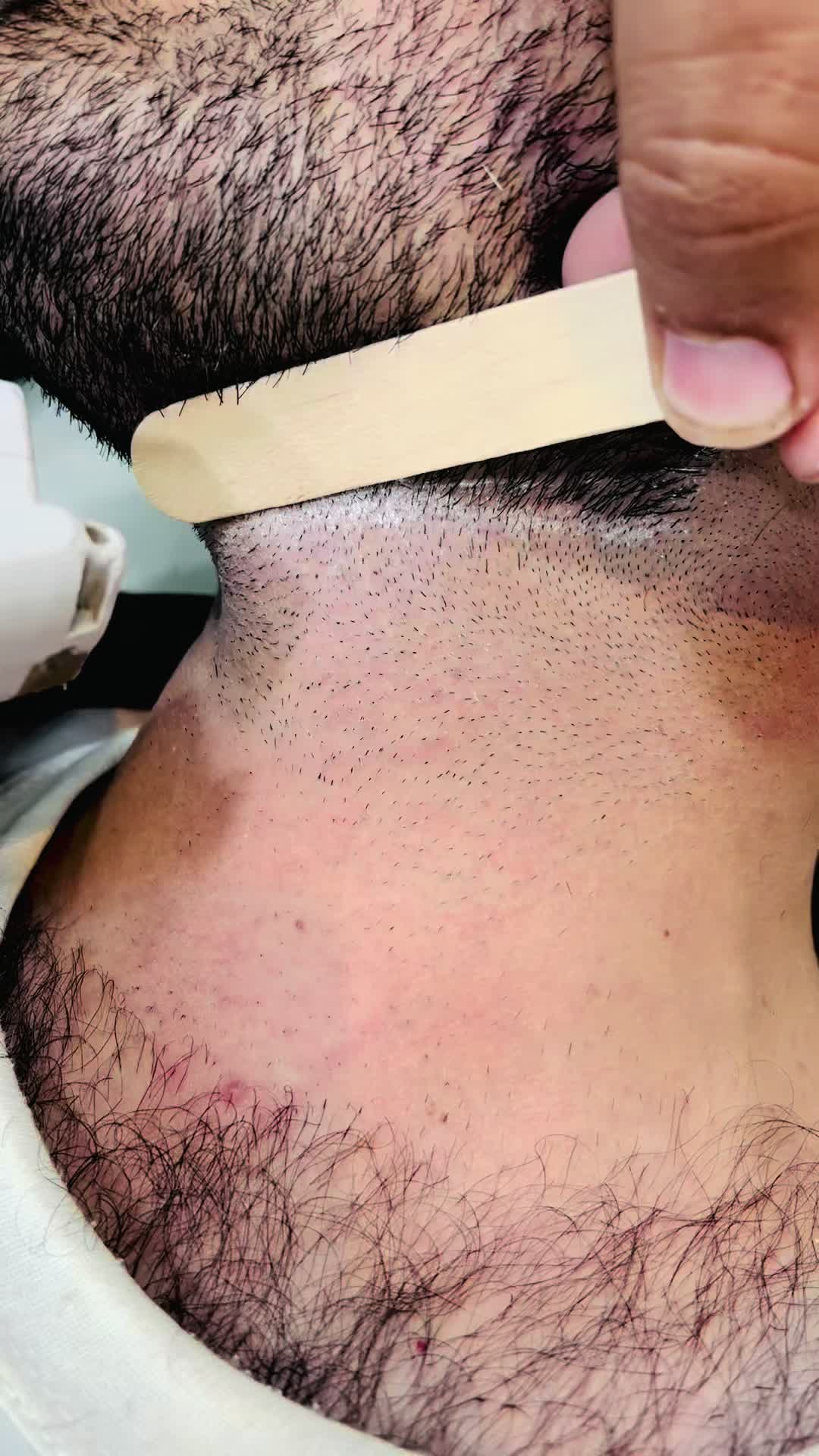 @Laser Grafix clinic