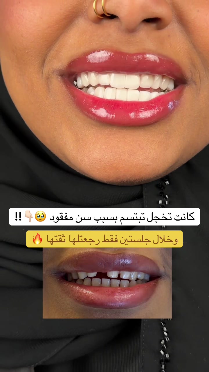 @Dr.lina_almasmoum
