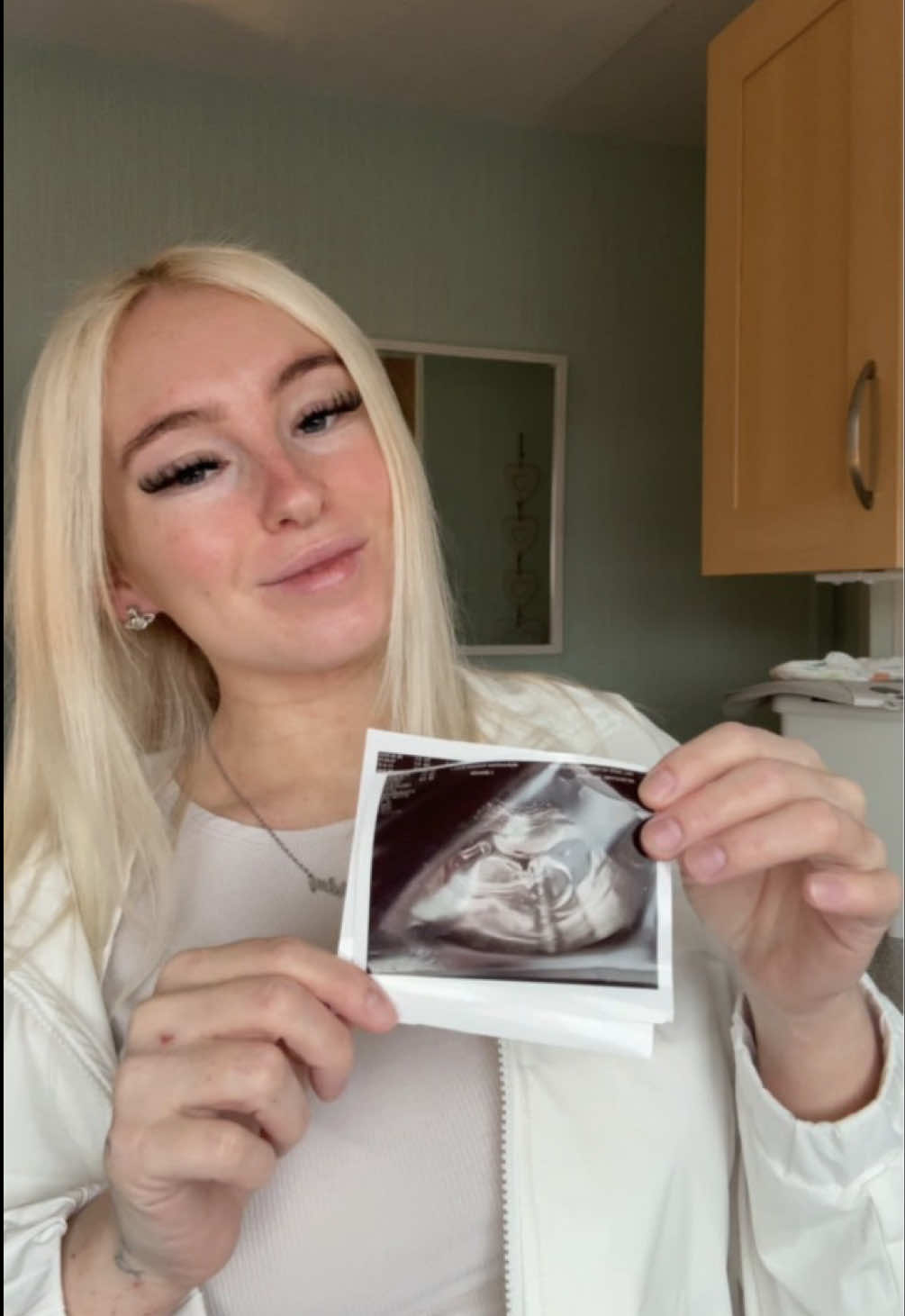 @Katie|Motherhood&Life🧿