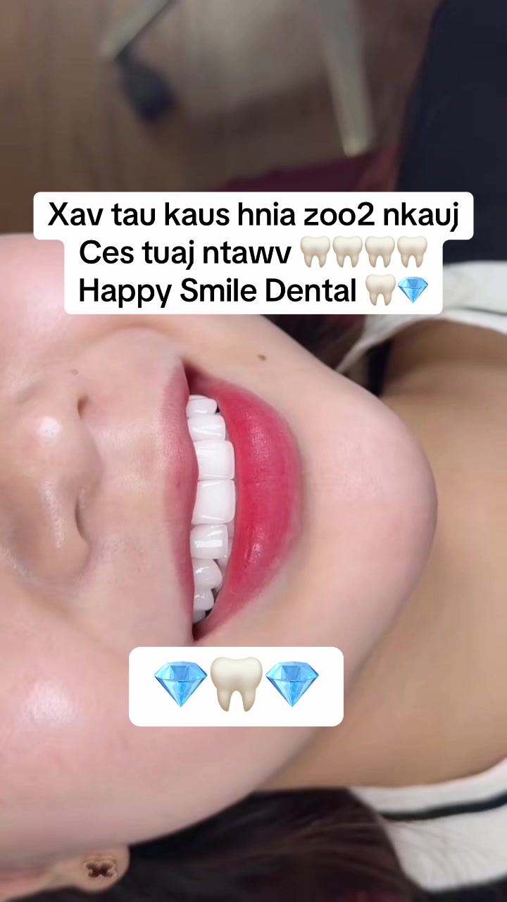 @๐ธ๐ฆTswqab yang ๐ฆ๐ธ