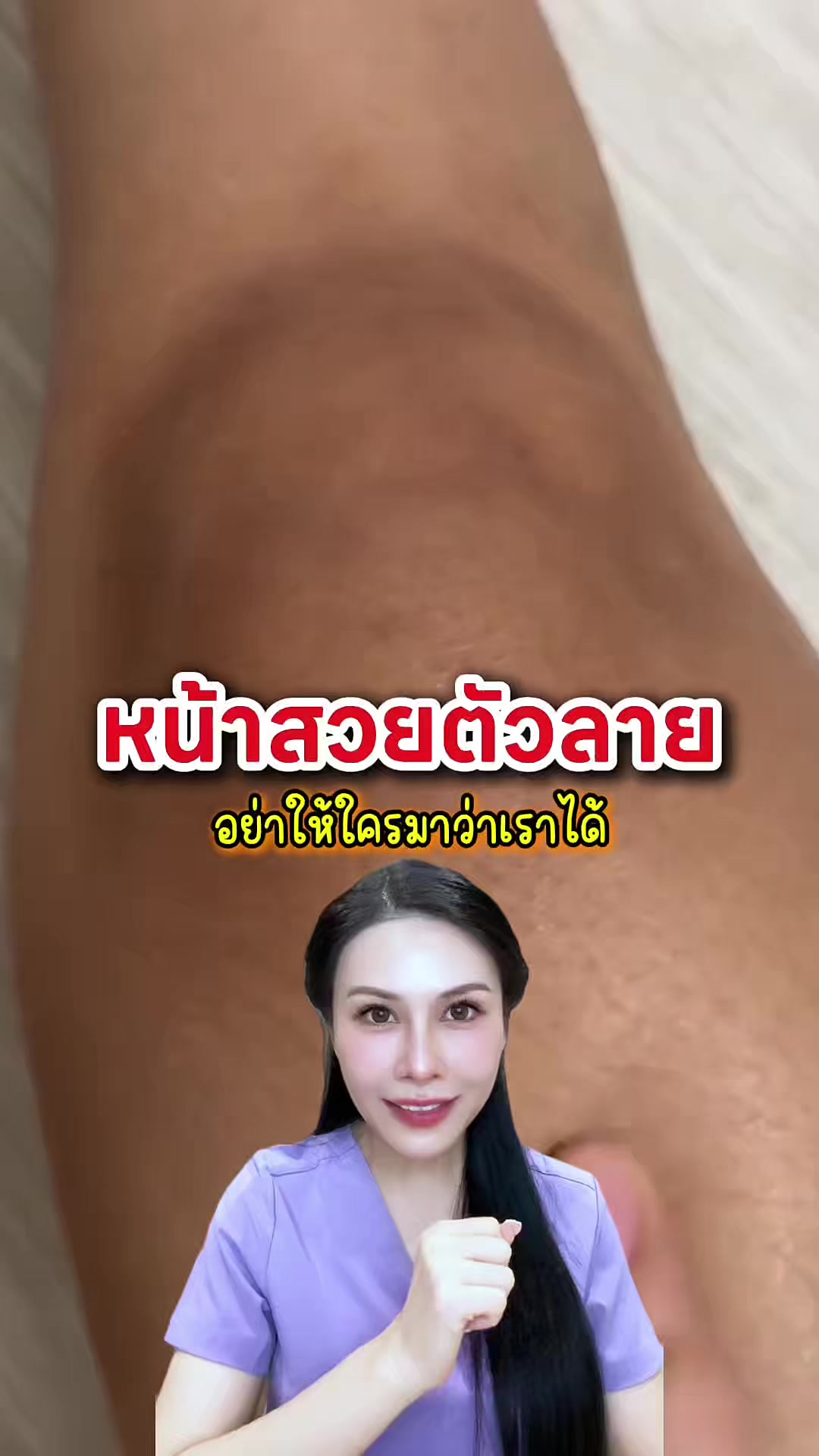 @พยาบาลอัญ