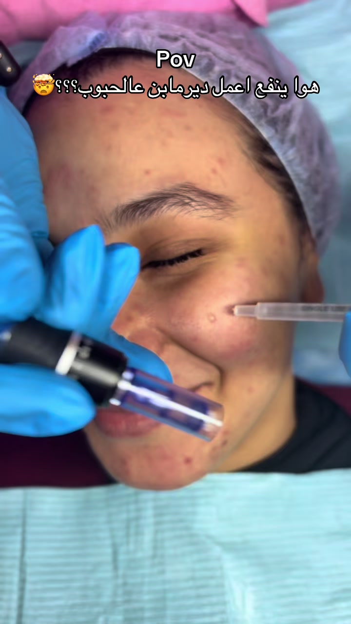 @menna_skintherapist