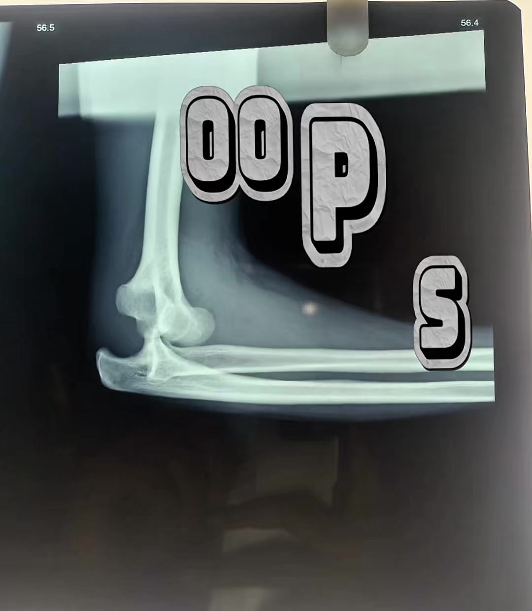 @Dr.Sanjay Gautam,Orthopedics🦴