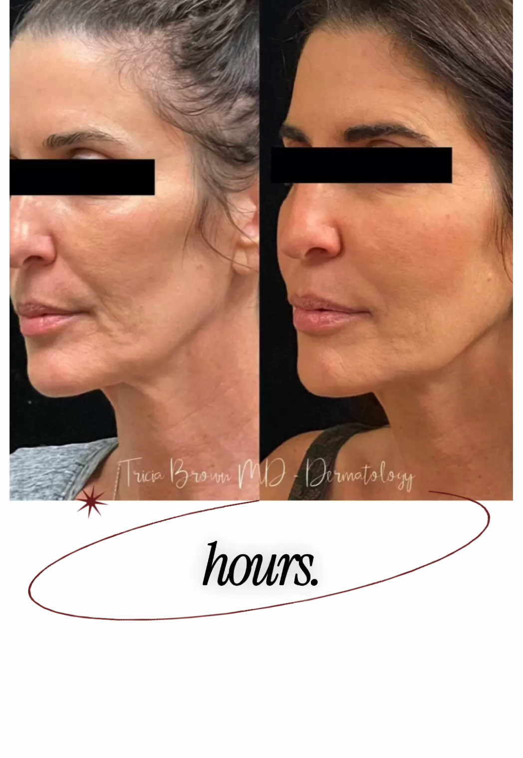 @AdvancedDermatology661