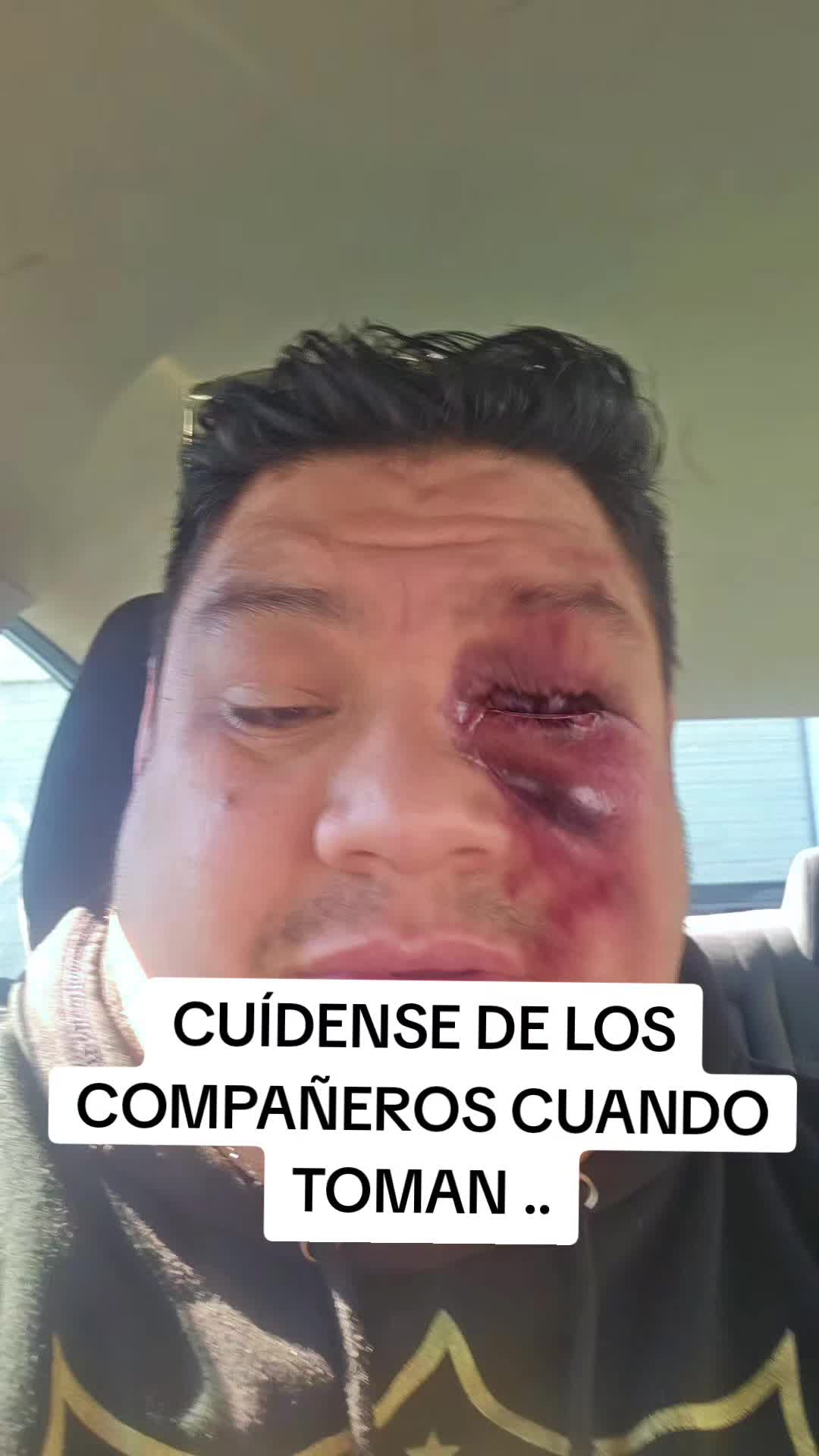 @Tio Eddie