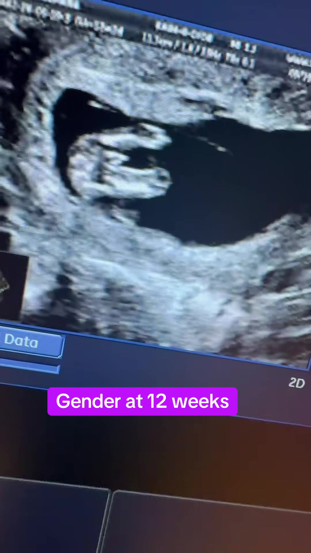 @PregnantSee Inc.