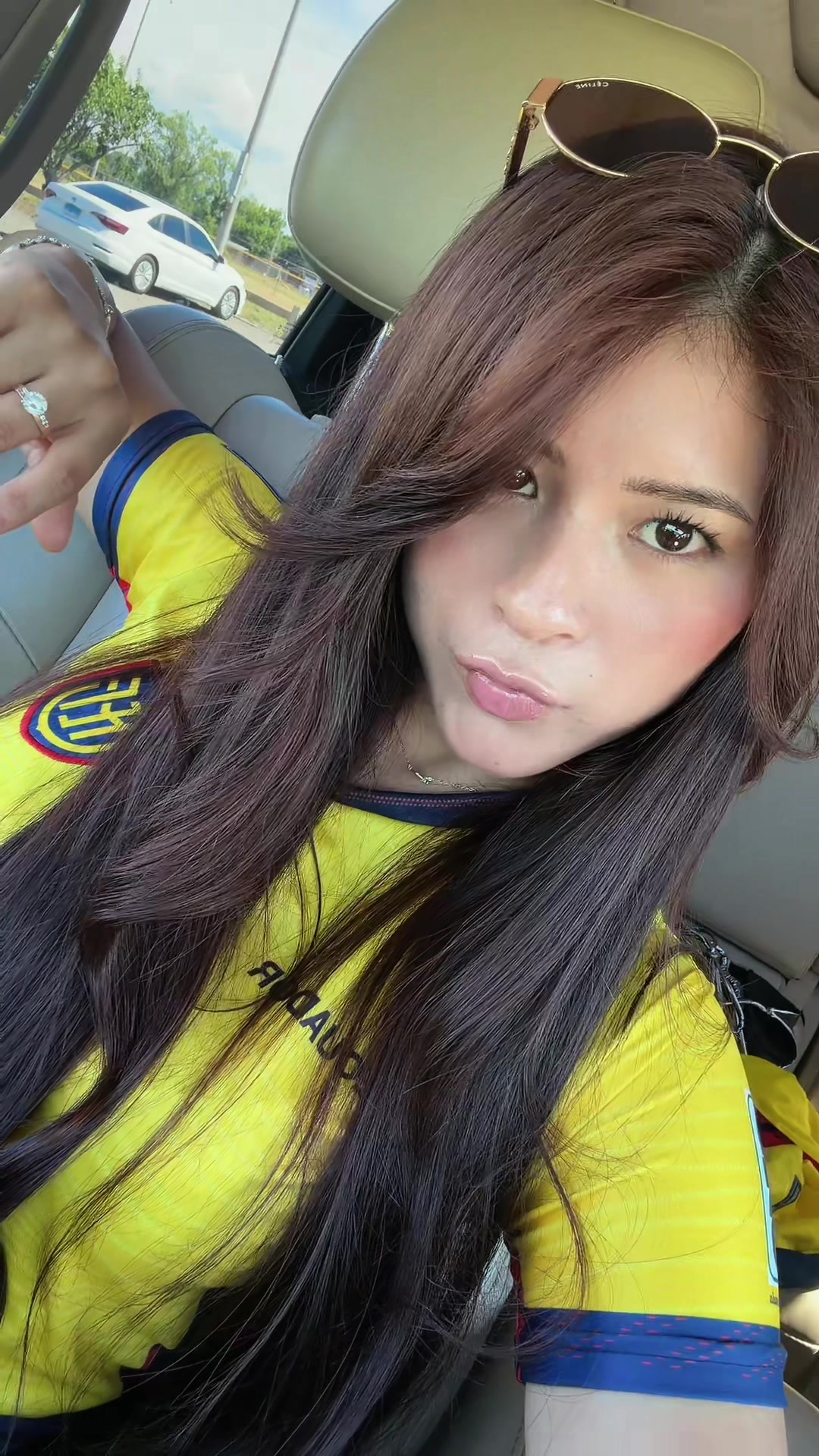 @Niky ayui