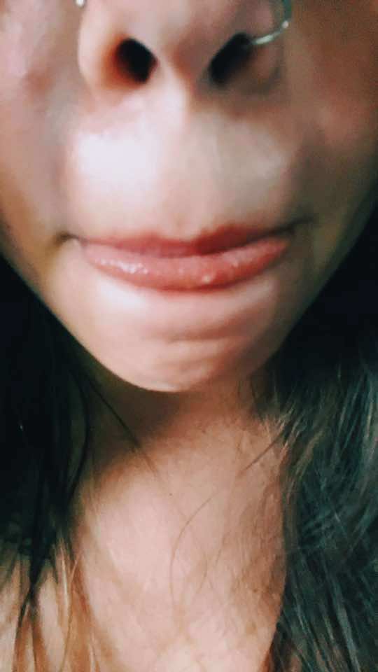 @💋