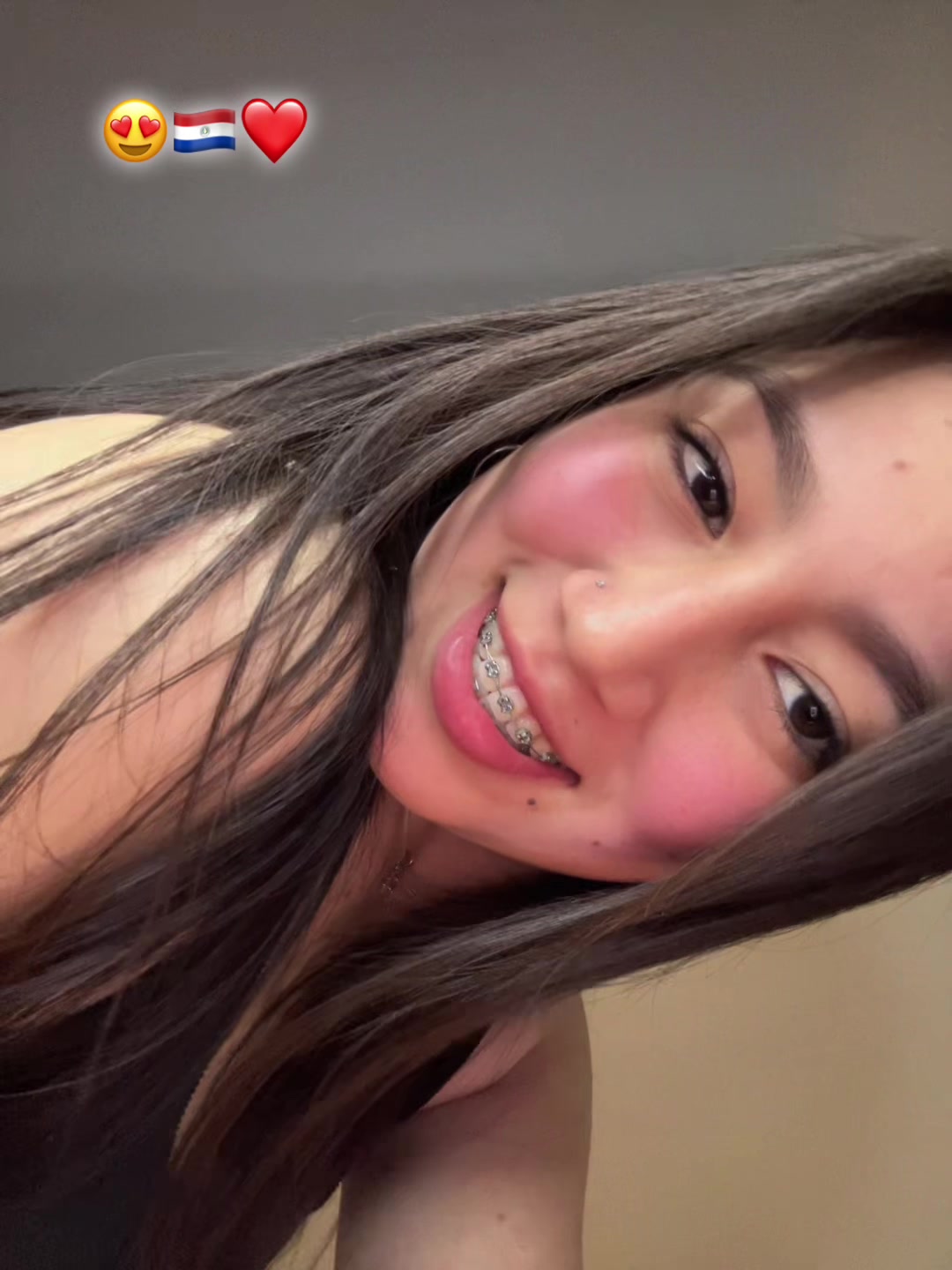 @๐ซ๐๐๐