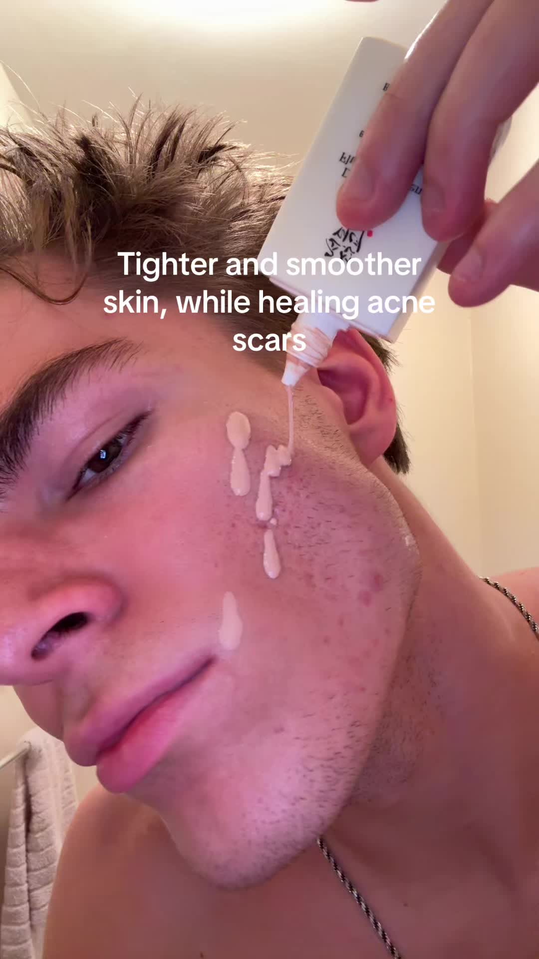 @Finn
