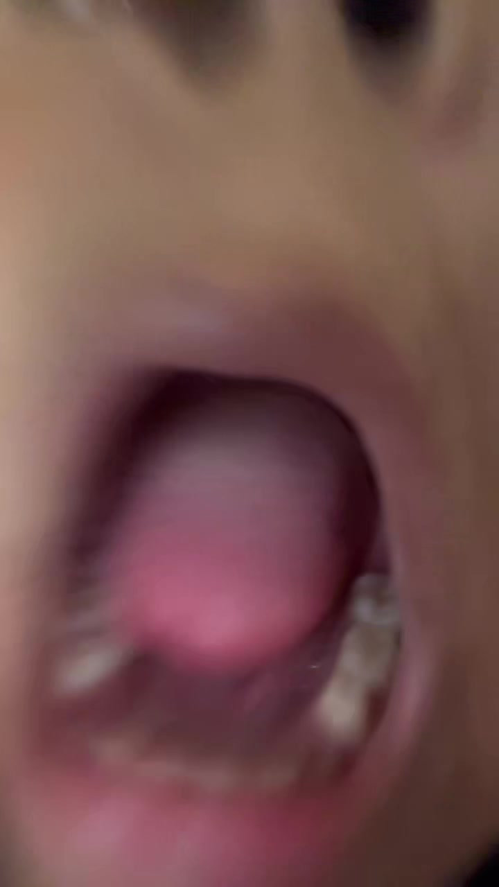 @rebeccayunker