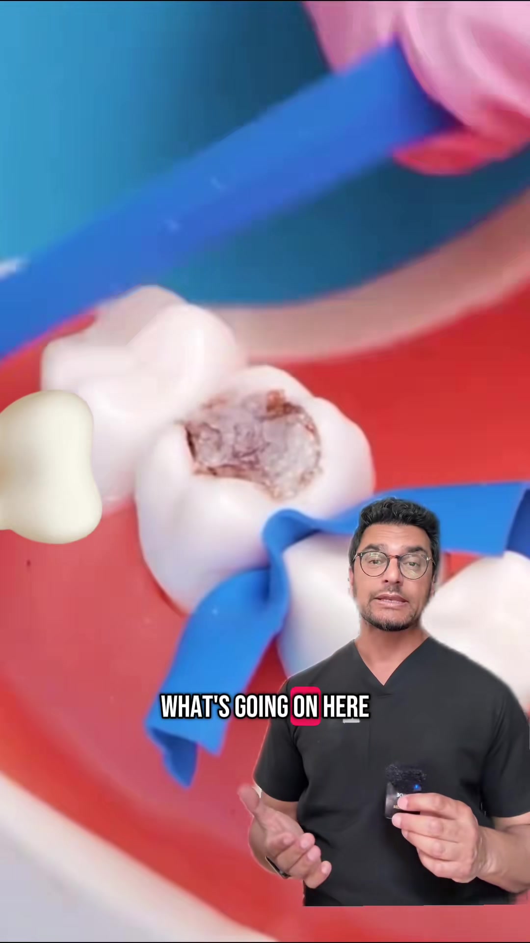 @Dentite