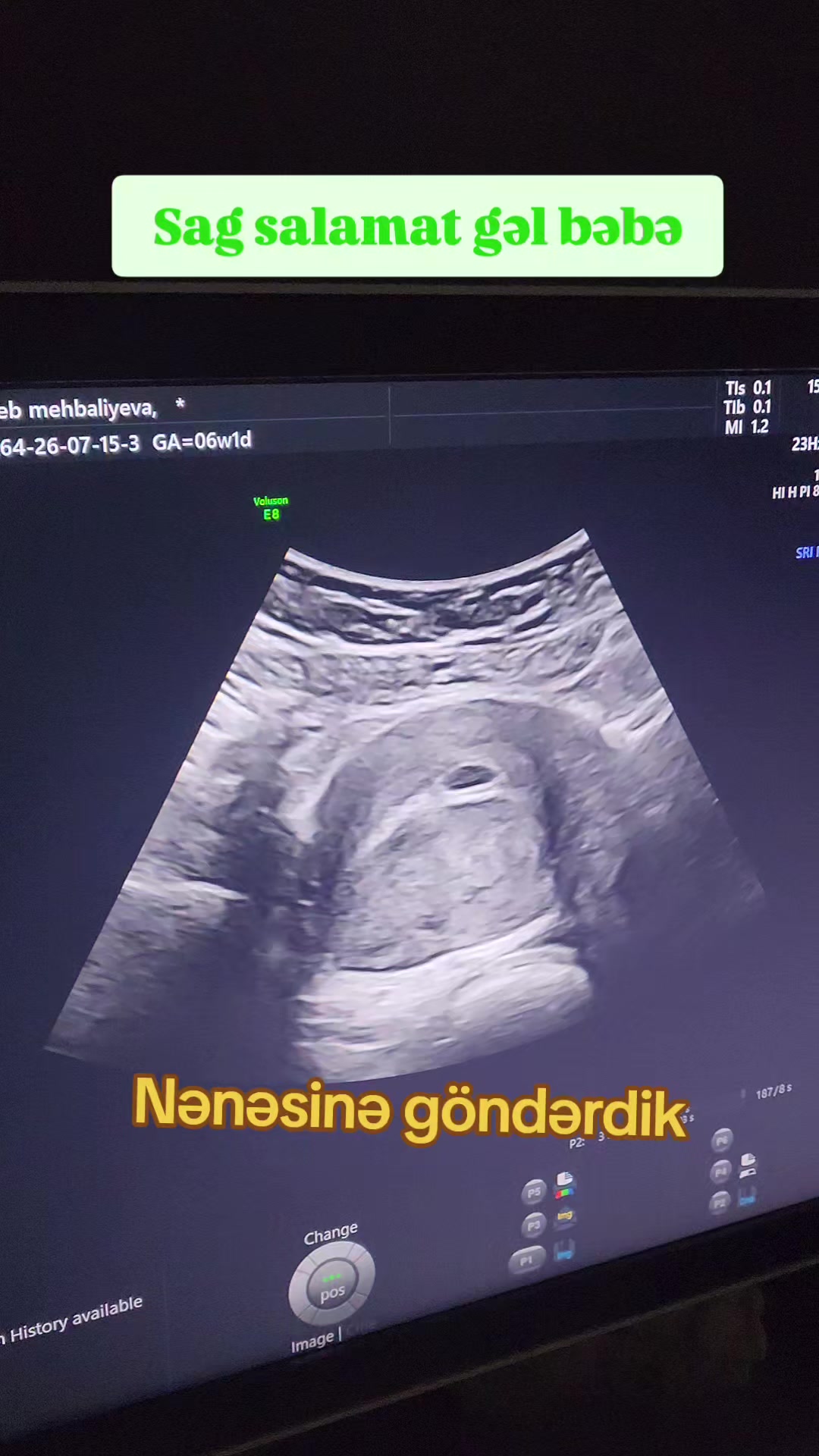 @Ginekoloq Esmira Hasanova