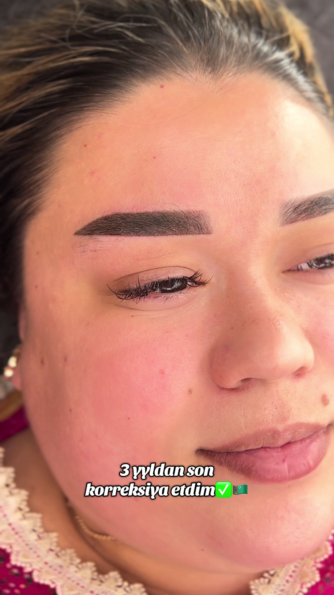 @guljana_laser_beautysalon