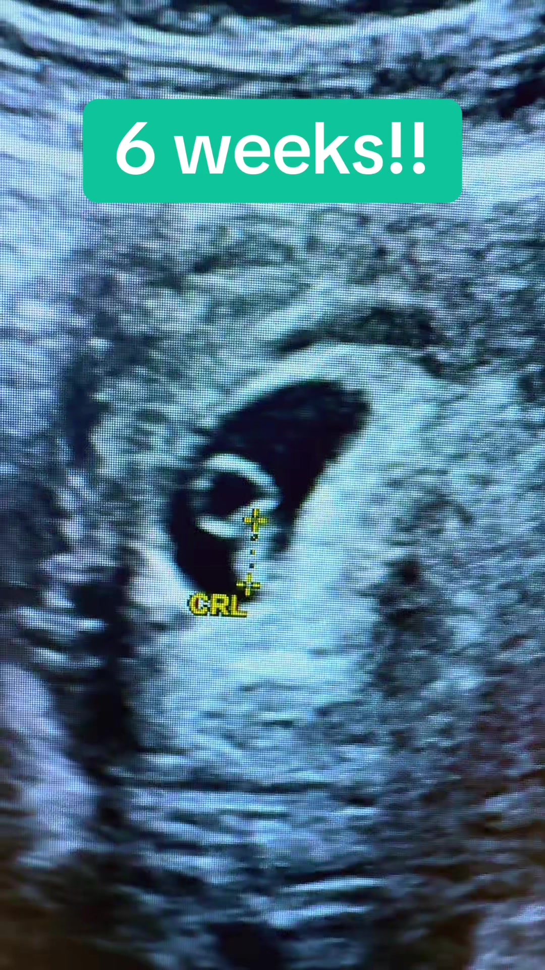 @PregnantSee Inc.