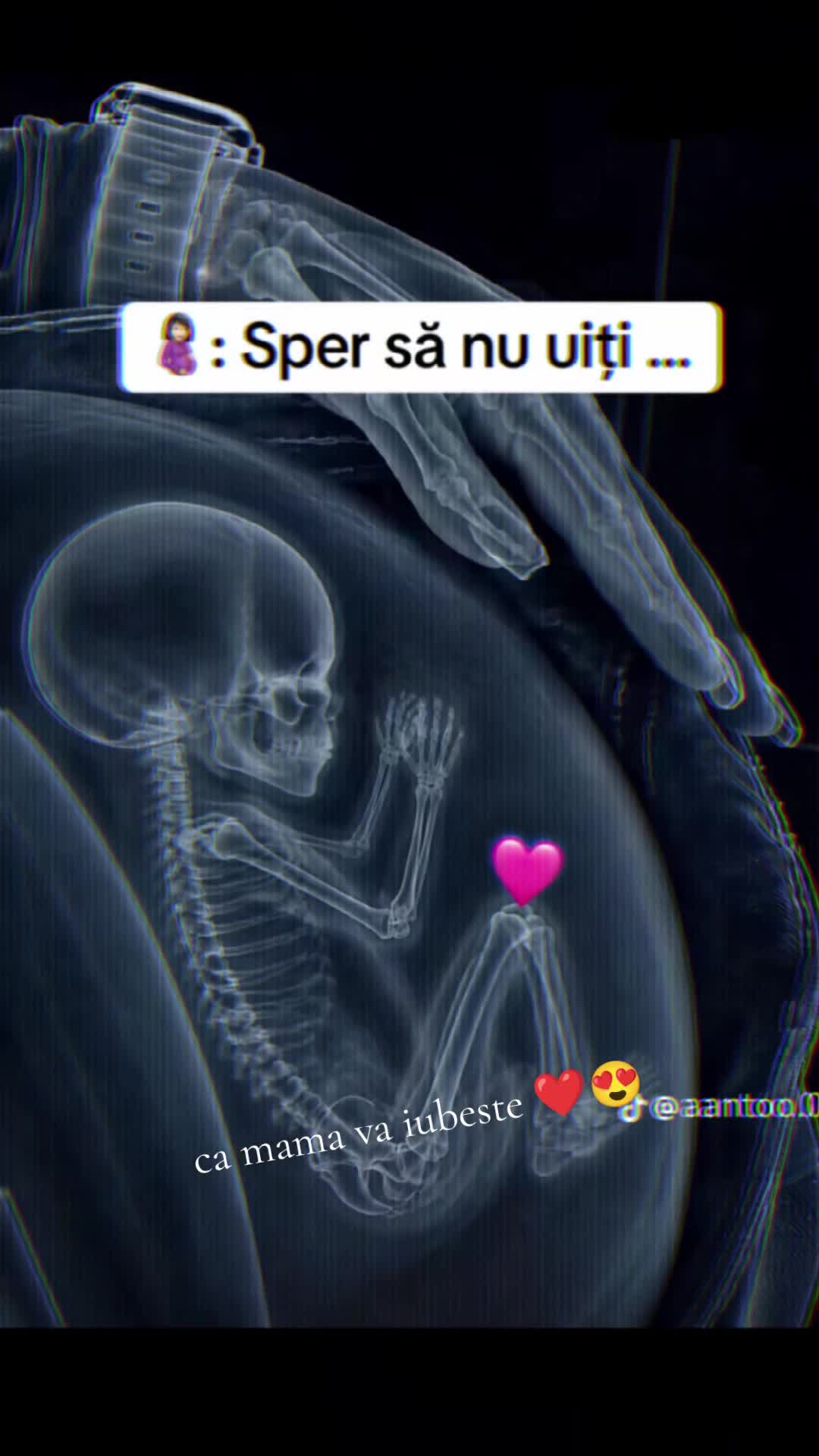 @Ely