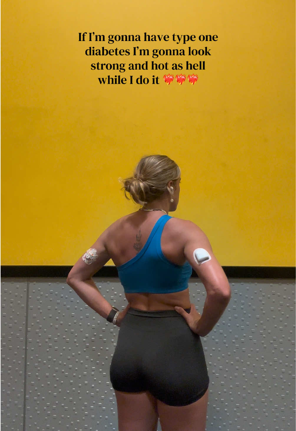 @Carrie 🦋 T1D