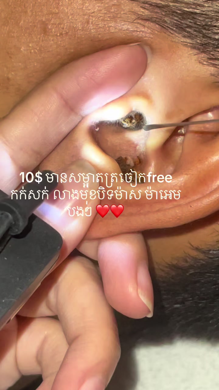 @ហាង សំអាតត្រចៀក 081 674455