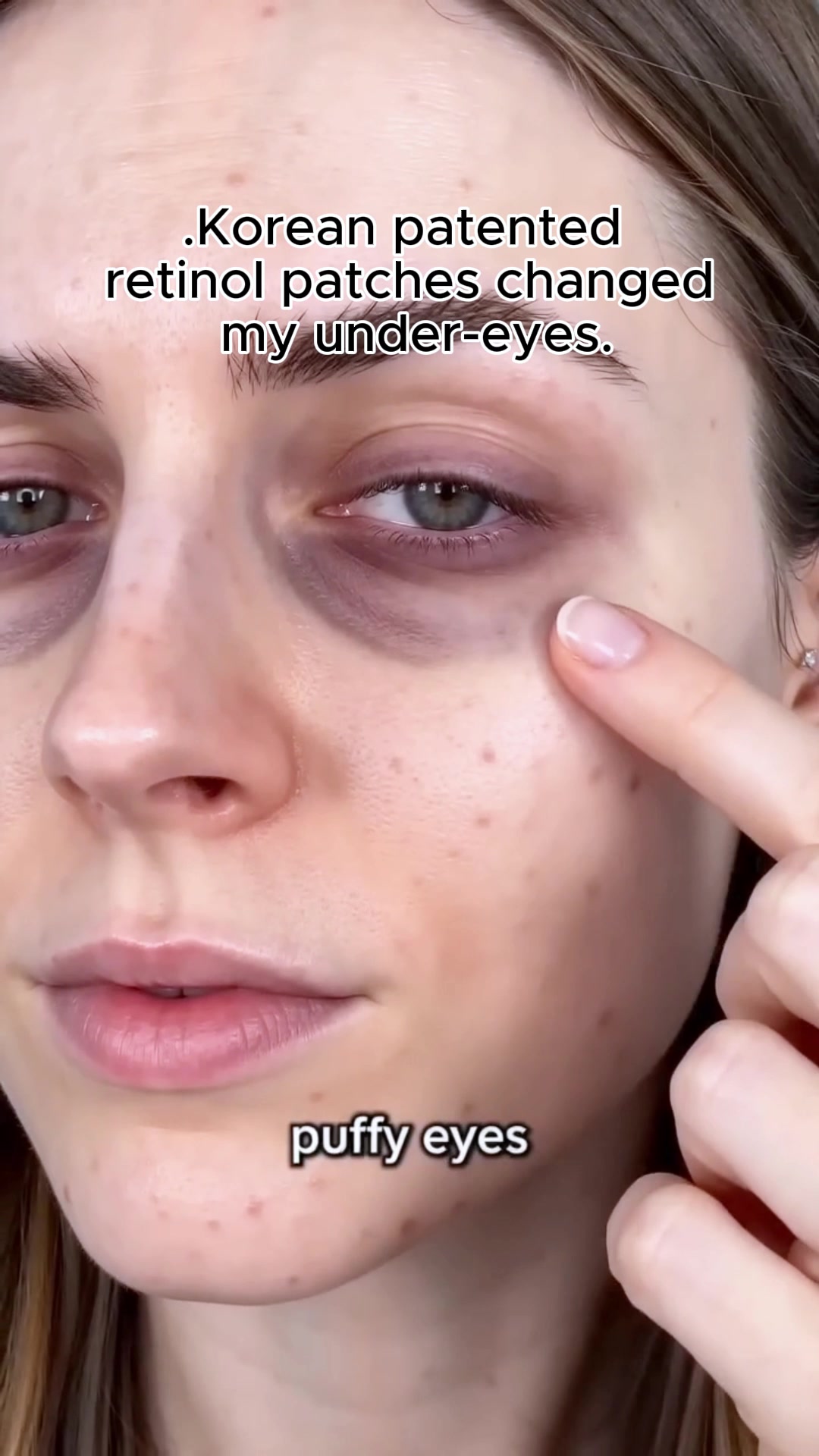 @iMethodBeauty_Alan