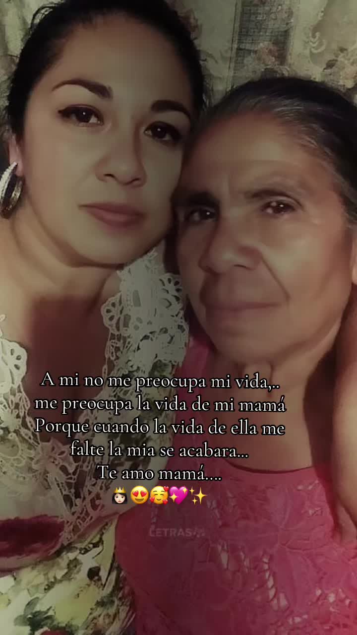 @🦁America Camargo 👑🇲🇽🥔🍟🌎