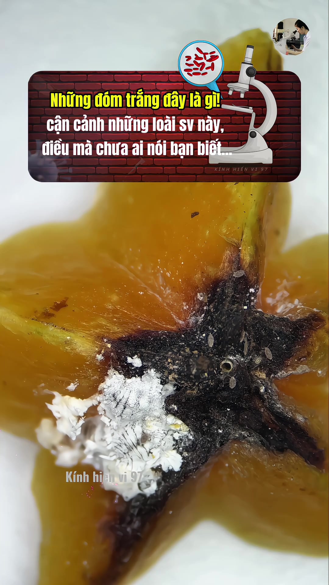 @Kính hiển vi 97