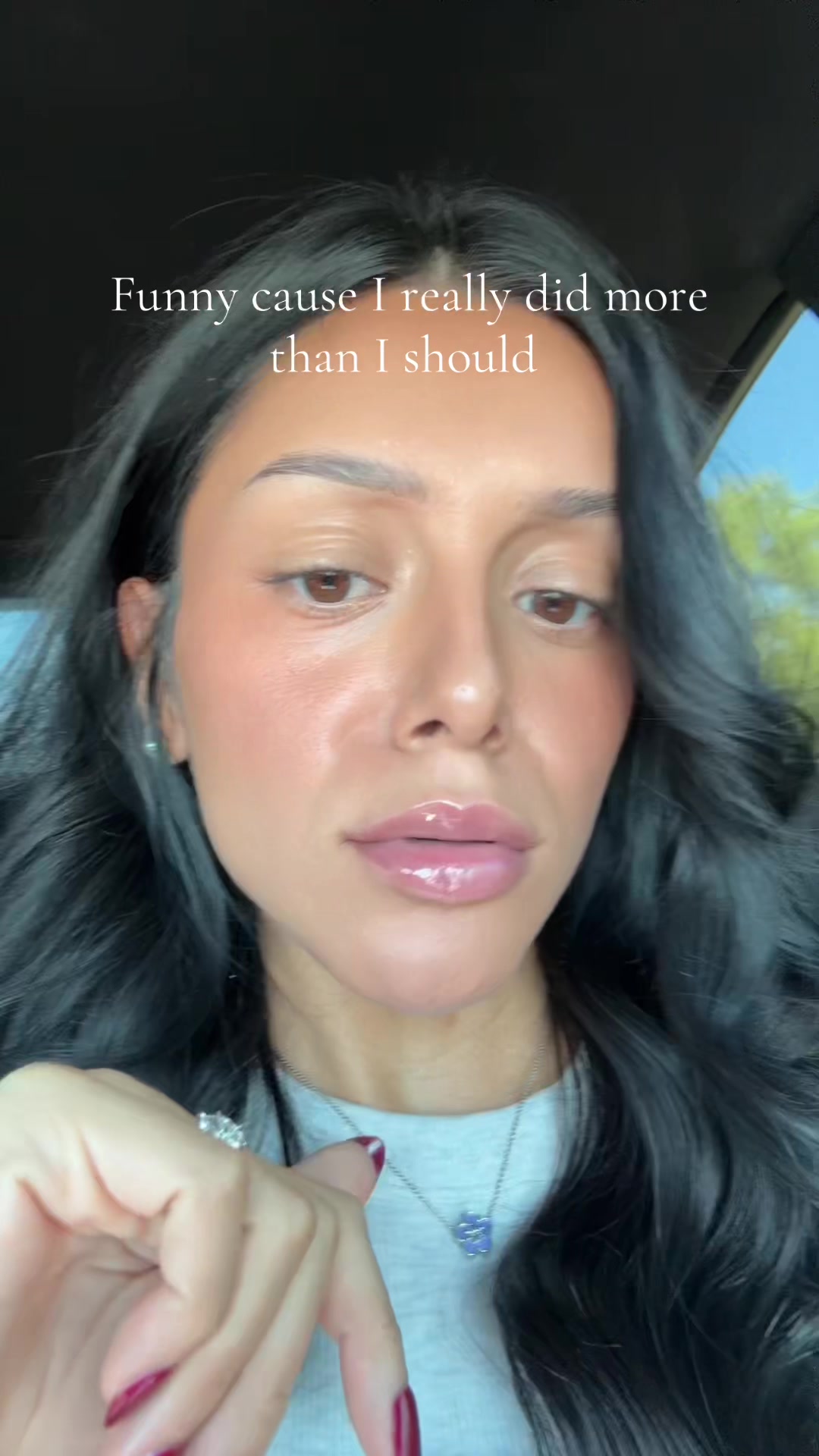 @AB