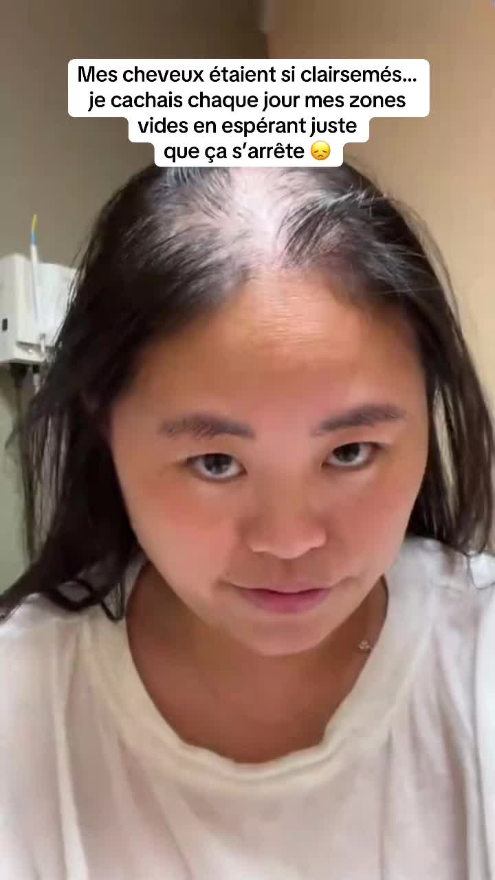 @Lux’Hair Growth