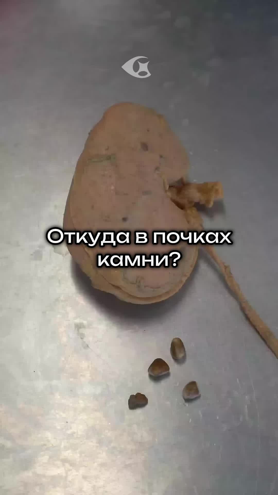 @Curiosity vision