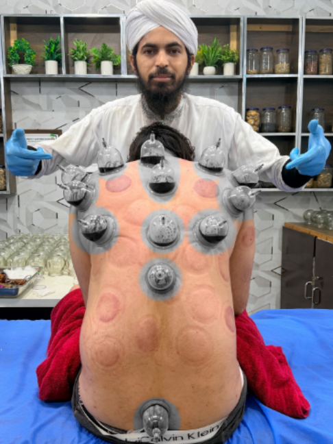 @Doctor & Hijama Cupping Clinic