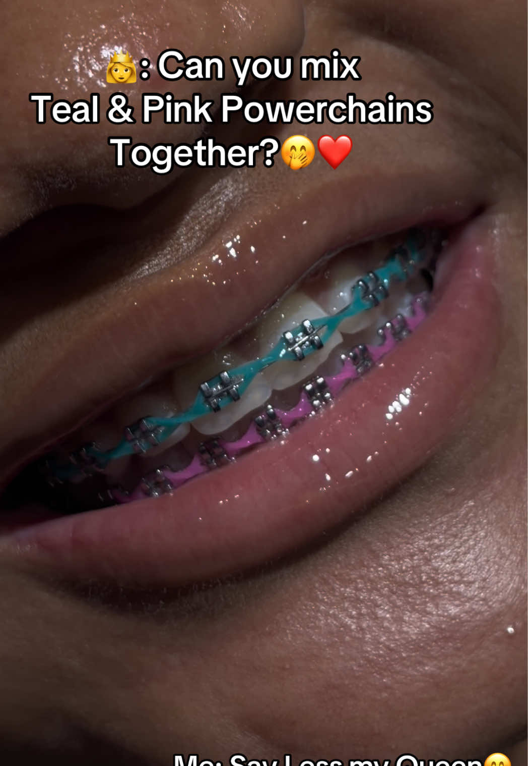 @Abuja Fashion Braces/Toothgems