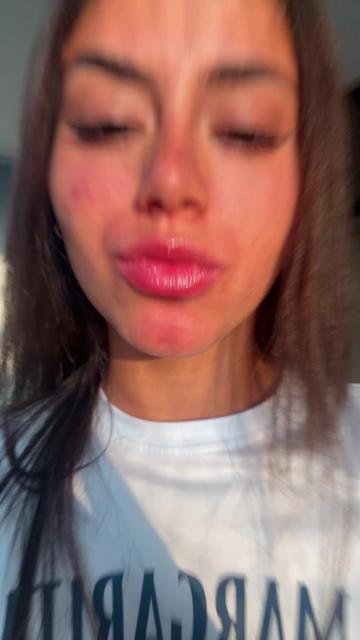 @Araujo